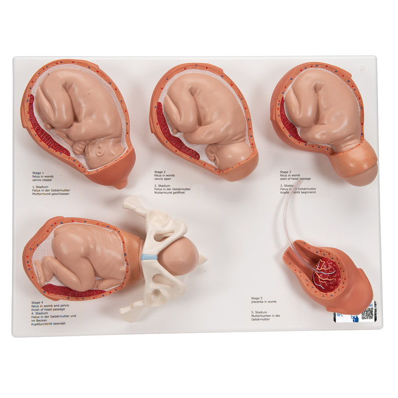 型號:1001259，3B/德國製
模型展示分娩過程五階段，每個階段置於底座。
各階段模型組包含胎兒在子宮內子宮頸關閉；胎兒在子宮內子宮頸打開；胎兒在子宮內頭部開始通過；胎兒在子宮和骨盆中 頭部完成通過；胎盤在子宮內。

.